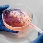 HPV and Throat Cancer